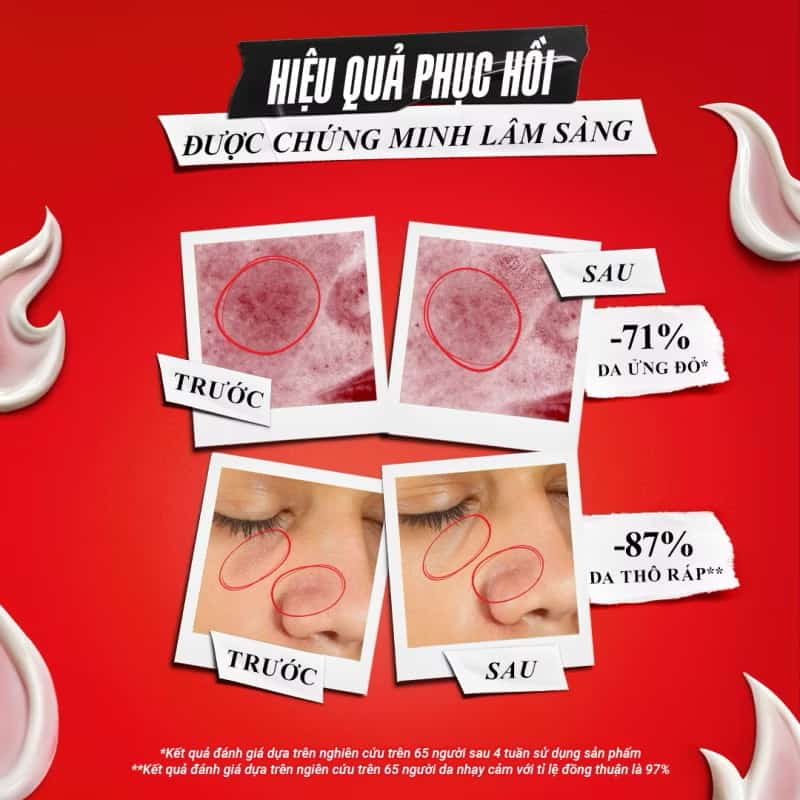 ￼Kem dưỡng phục hồi &amp; làm dịu da Ultra Facial Meltdown Recovery Cream 50ml 